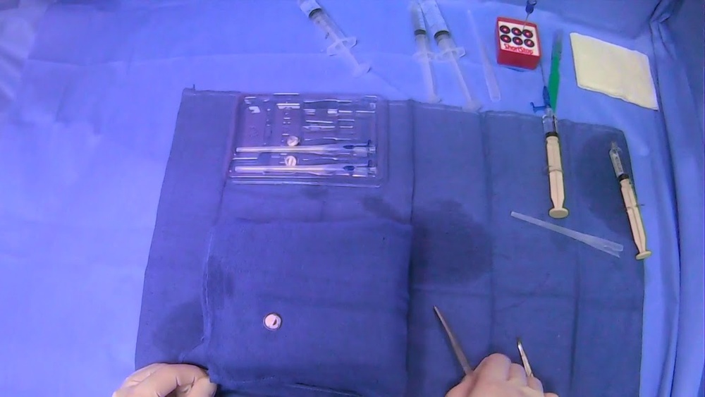 How to Remove T Fasteners